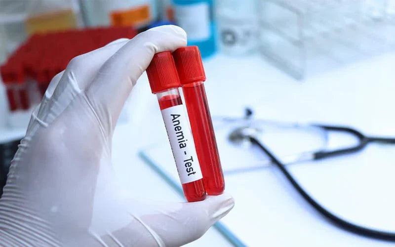 Anemia diagnosis: a common condition you should know